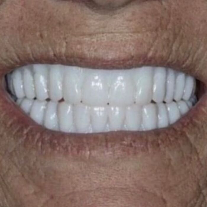 Close-up of a smile with unusually large, perfect teeth, adding a confusing and funny element to the image.