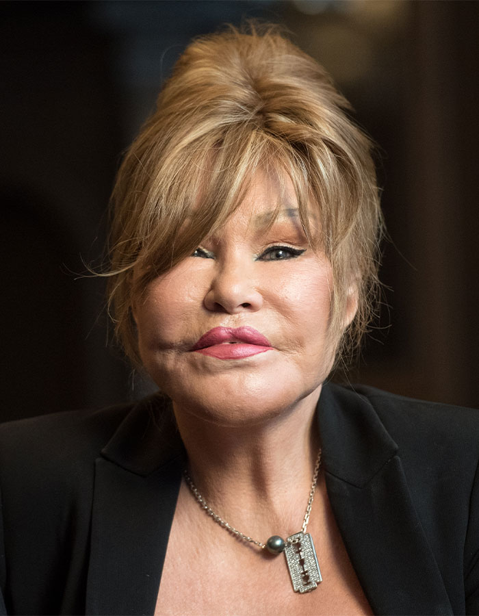 'Catwoman' Jocelyn Wildenstein, Notorious For Extreme Plastic Surgeries, Passes Away At 84 'Catwoman' Jocelyn Wildenstein, Notorious For Extreme Plastic Surgeries, Passes Away At 84