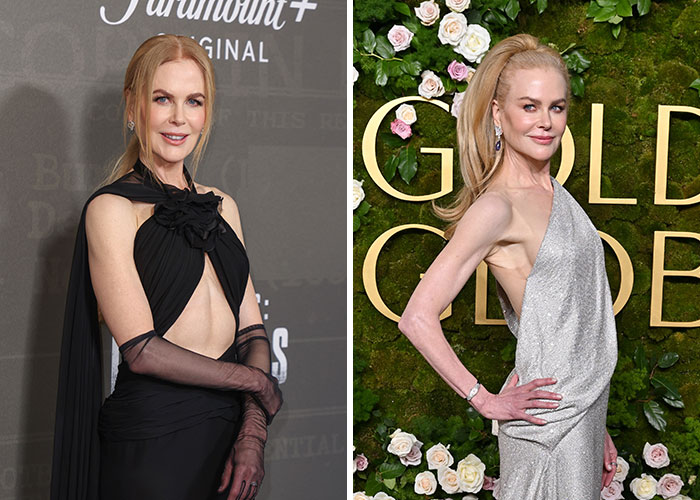 Actress at Golden Globes, showcasing stunning weight loss transformation in elegant gowns.