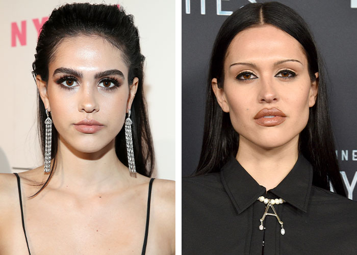 Two women side by side, showcasing effects of plastic surgery, highlighting dramatic transformations.