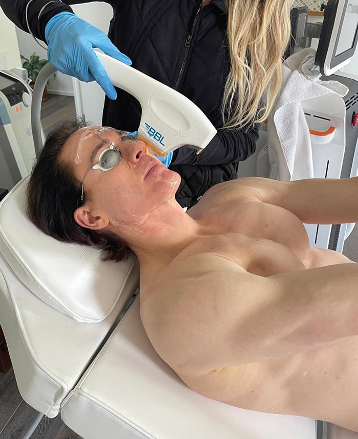 A man receiving a facial treatment, surrounded by equipment and wearing protective eyewear.