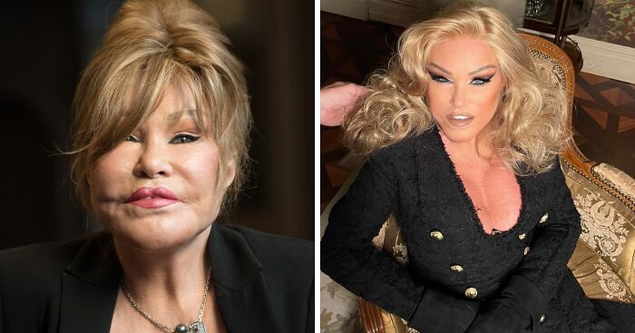 ‘Catwoman’ Jocelyn Wildenstein, Notorious For Extreme Plastic Surgeries, Passes Away At 84