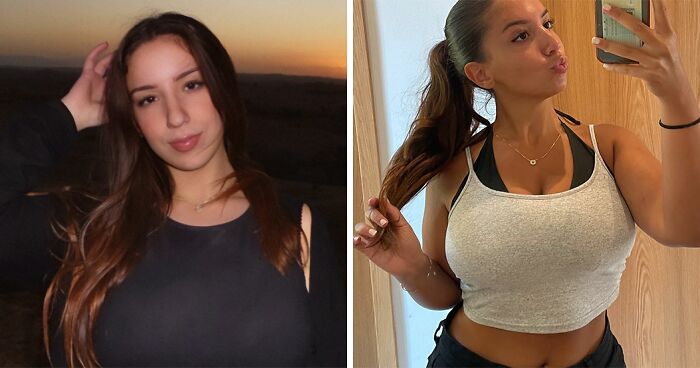 “Always In Pain”: Woman’s 30J Breast Reduction Plea Rejected, Faces Harassment