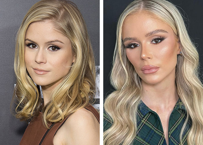 Two side-by-side images of a celebrity before and after plastic surgery, showing significant changes in appearance.