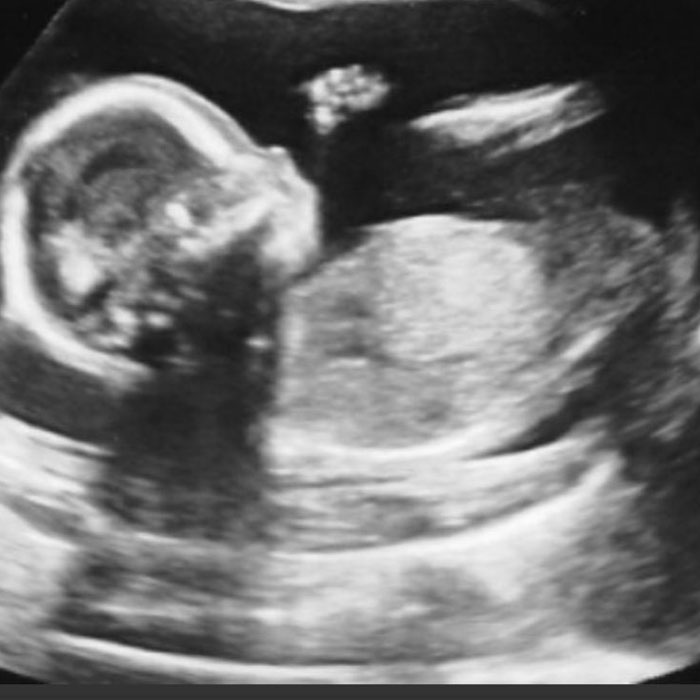 From The Voice to &ldquo;I Do&rdquo;: How Gwen Stefani and Blake Shelton's Love Story Began