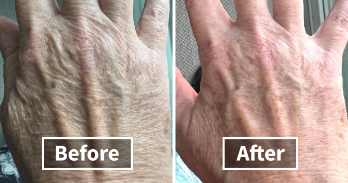 19 Beauty Solutions For Those Winter Issues Nobody Wants To Talk About