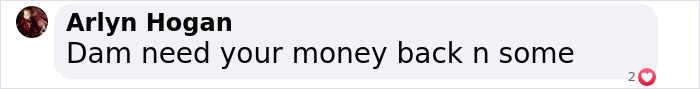 "Comment on hair transplant results reads, 'Dam need your money back n some.' "Comment on hair transplant results reads, 'Dam need your money back n some.'