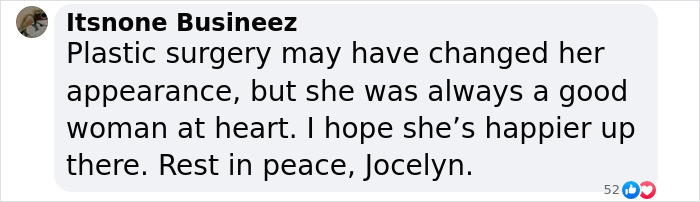 'Catwoman' Jocelyn Wildenstein, Notorious For Extreme Plastic Surgeries, Passes Away At 84 'Catwoman' Jocelyn Wildenstein, Notorious For Extreme Plastic Surgeries, Passes Away At 84