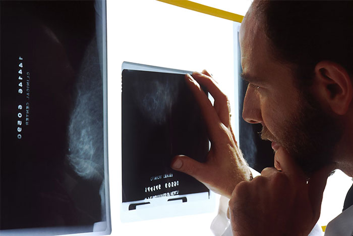 Man examining timestamped medical X-ray images on a lightbox, highlighting moments that saved lives later.
