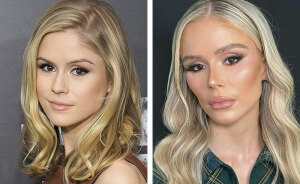“Looked Better Before”: 17 Stars People Say Look Unrecognizable After Plastic Surgery