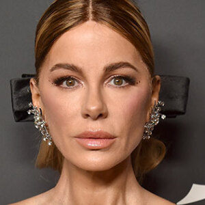 “Looked Better Before”: 17 Stars People Say Look Unrecognizable After Plastic Surgery