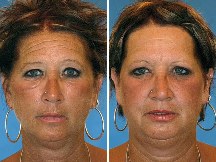 Twin sisters side-by-side in a study highlighting the impact of divorce and poor diet on facial appearance.