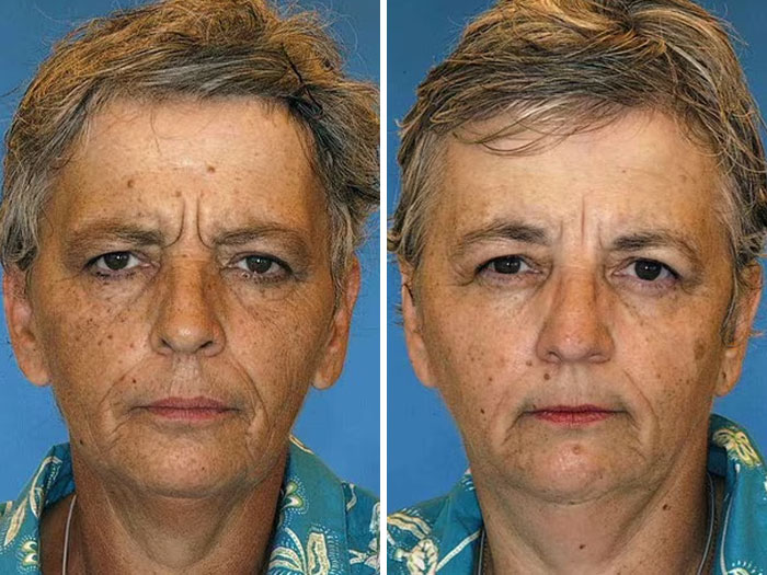 Twins showing impact of divorce and bad diet on facial features in viral study.