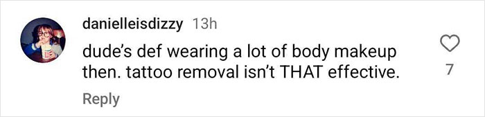 Comment on Pete Davidson's appearance post tattoo removal.