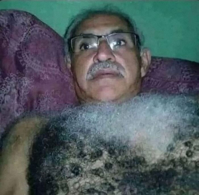 Man with glasses lying on a patterned pillow, showcasing unusual chest hair texture; weird images theme.