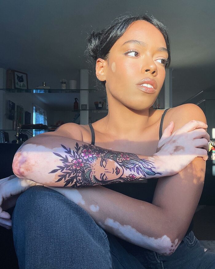Artist showcasing vitiligo body art on arm, promoting self-acceptance, with sunlight highlighting her features.