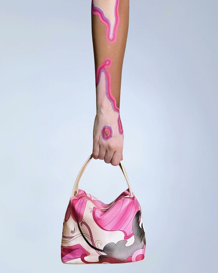 A hand with vitiligo transformed into body art, holding a pink and white patterned handbag.