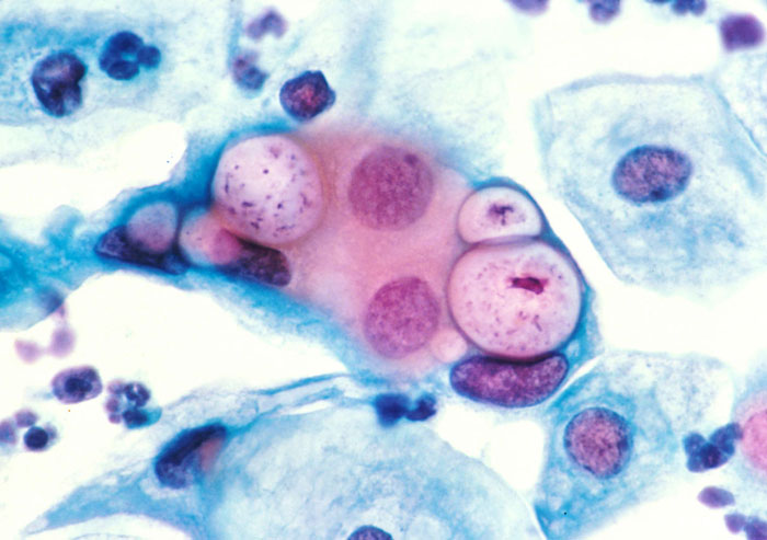 Células microscópicas teñidas en rosa y azul, observadas en estudio de laboratorio.