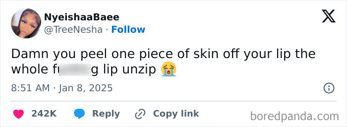 Tweet humorously celebrating Black culture with relatable lip peeling experience.