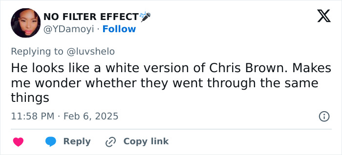 Tweet expressing comparison between Justin Bieber and another artist, raising concerns about Bieber's health. Tweet expressing comparison between Justin Bieber and another artist, raising concerns about Bieber's health.