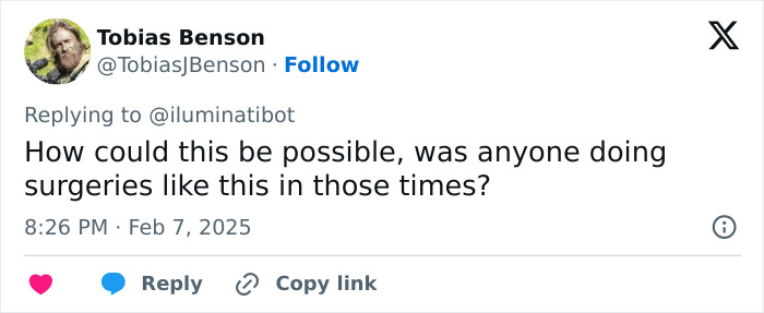 Tobias Benson's tweet questioning gender surgeries, referencing French President's wife controversy.