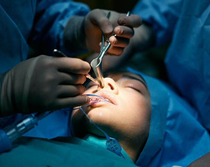 A patient undergoing a rare cosmetic procedure, with surgeons in blue scrubs operating on the nose in a well-lit room.