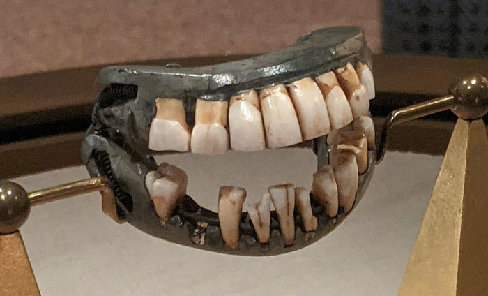 Dientes con estructura metálica en exhibición, resaltando una expresión graciosa compartida por estudiantes.