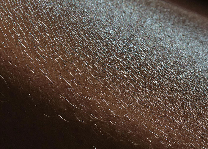 Close-up of skin texture, illustrating considerations for getting inked.