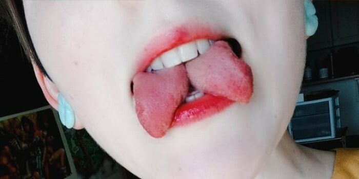 Person with a split tongue, showcasing an unusual cosmetic procedure.