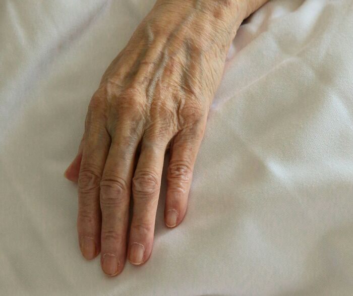 Elderly woman's hand resting on white fabric, showcasing the female body's aging process.