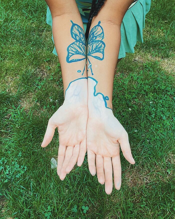 Vitiligo body art: blue butterfly design on forearms, enhancing natural skin patterns against a grassy background.