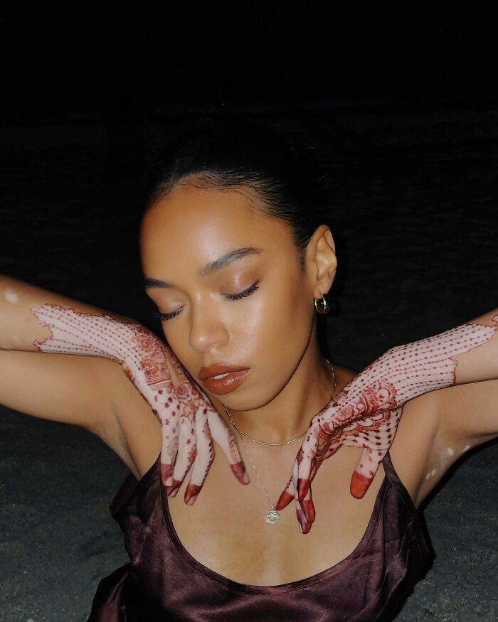 A woman with vitiligo creates intricate body art on her hands, embracing self-acceptance.