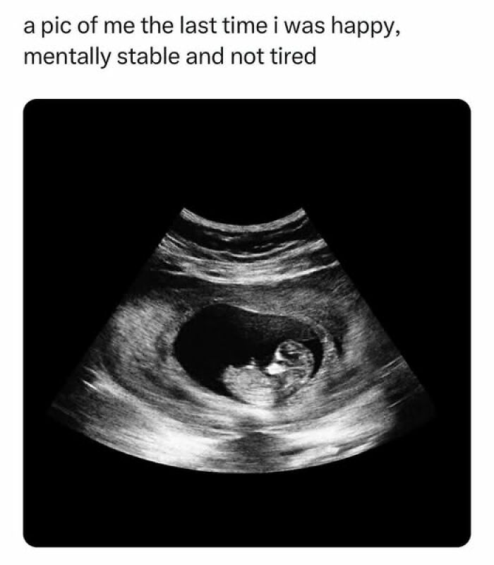 Ultrasound image with humorous text about mental health from a collection of memes.