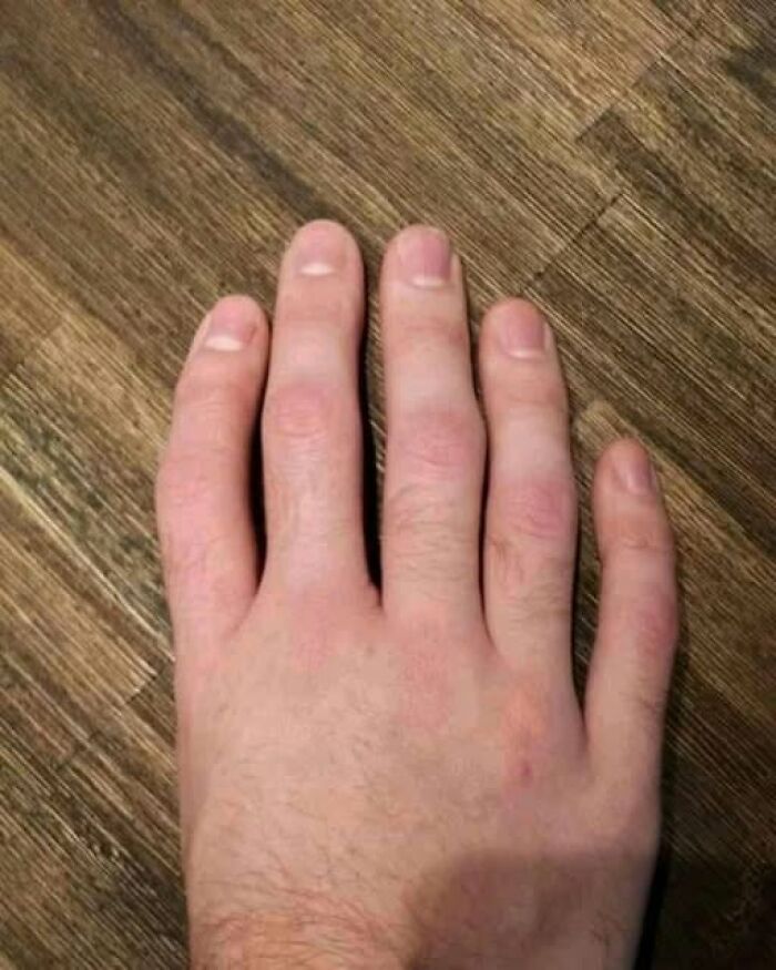 A hand with an unusual toe-like appearance on a wooden surface, showcasing weird image characteristics.