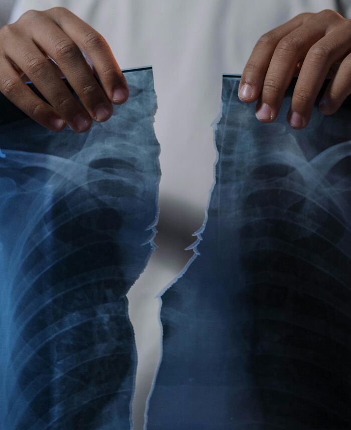 "Torn X-ray held by hands, symbolizing future predictions aged bad."