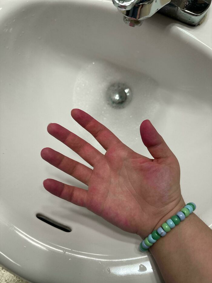 Hand dyed pink in sink mishap, wearing a beaded bracelet; a classic example of Valentine's Day fails.