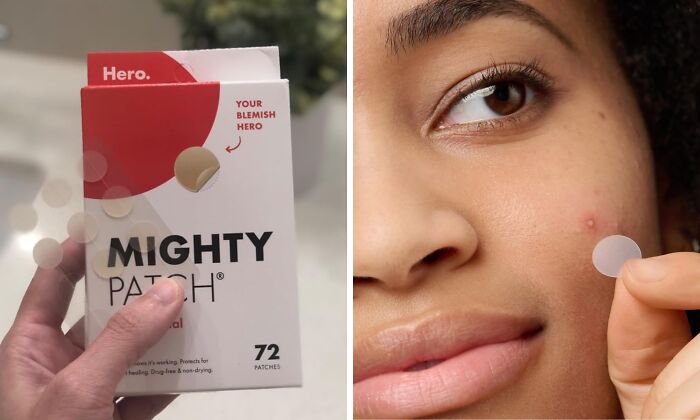 Mighty Patch for blemish treatment, showing packaging and application on skin.
