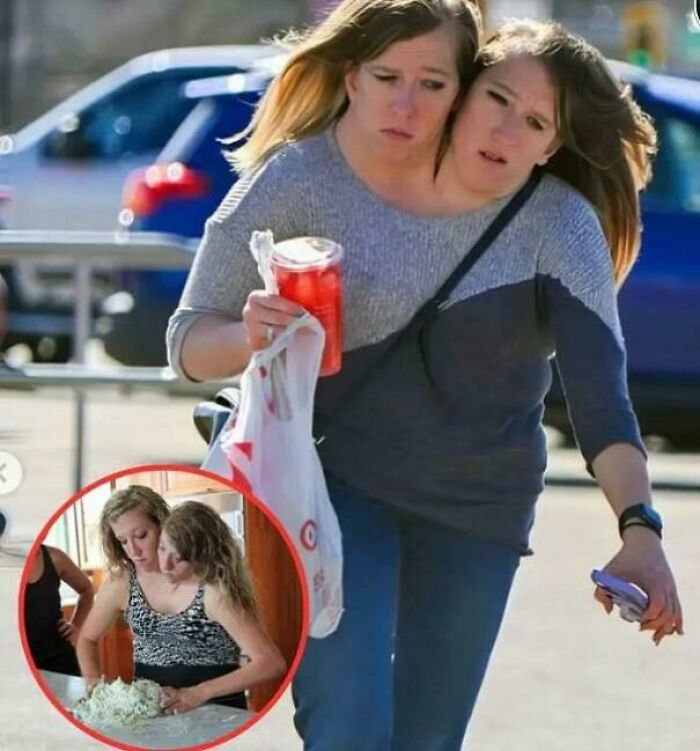 Conjoined twins outdoors with drinks, inset of them cooking, highlighting interesting facts about their lives.