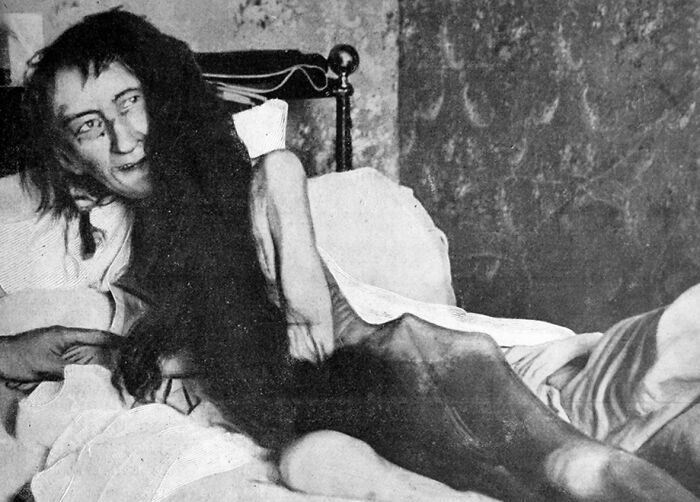 A frail person with long hair lying in bed, relating to photographs with terrifying backstories.