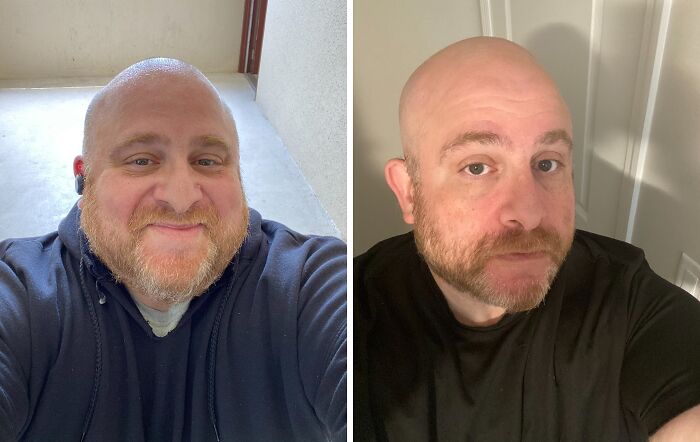 Man showing weight-loss transformation, smiling in the before photo and appearing slimmer in the after photo.