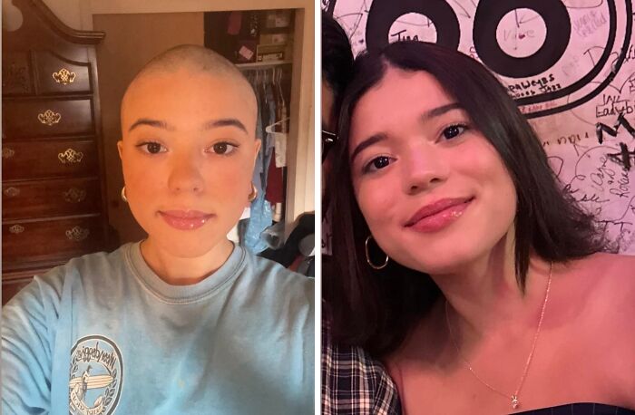 Two photos side by side of a young woman in different phases, showcasing a past and present comparison.