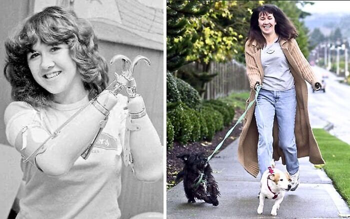 Young woman with prosthetic hook hands smiling in black and white photo, and a woman happily walking dogs outdoors in color.