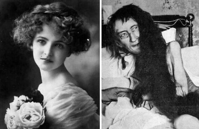 Side-by-side black and white photos showing a young woman and a person with extraordinarily long hair, highlighting strange Earth phenomena.