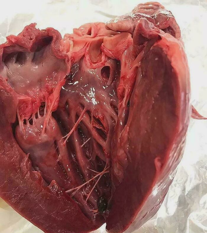 Opened heart showing chambers, valves, and chordae tendineae, raw anatomical specimen, medical pics