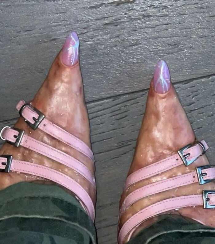 Feet with pointed pink sandals and nails painted with lightning design, an example of awful taste but great e*******n.