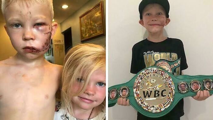 Two children with facial injuries, one holding a championship belt, illustrating bizarre and unsettling events worldwide.