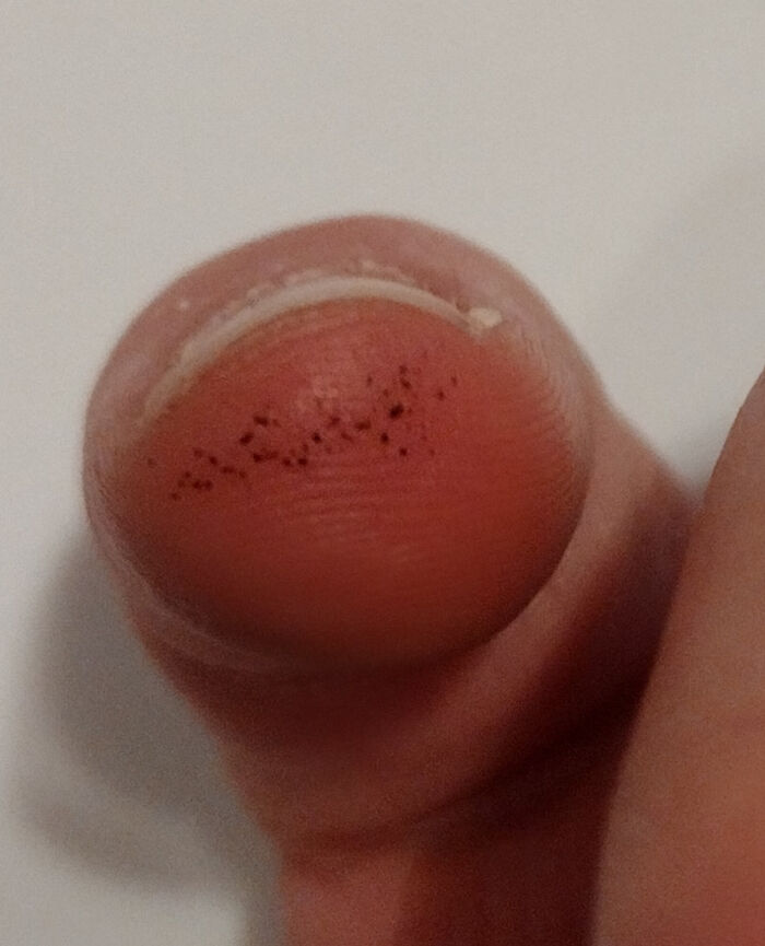 Close-up of a fingertip with tiny black dots, one of 136 times people saw something moderately interesting to share.