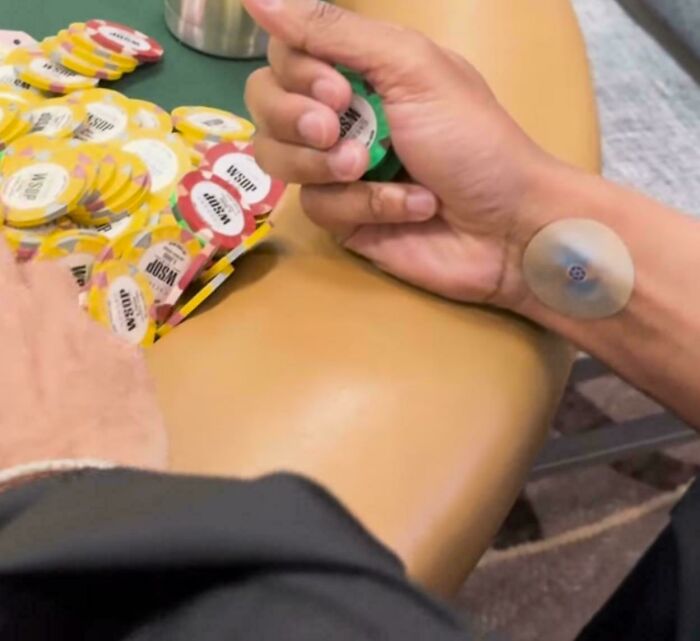 Person holding poker chips with a mysterious object attached to their wrist, sitting at a casino table.