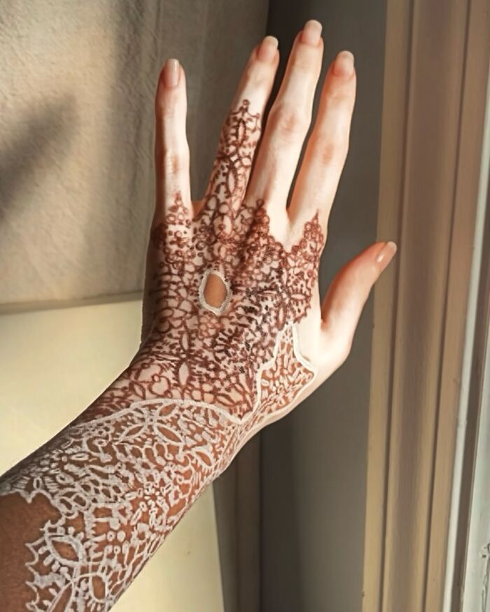 Vitiligo body art on an outstretched hand, featuring intricate lace designs, promoting self-acceptance.