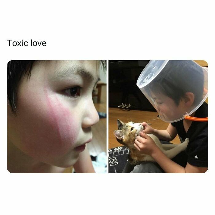 Child with a red cheek from being licked by a cat, wearing a protective cone; heartwarming moment with pet joy.